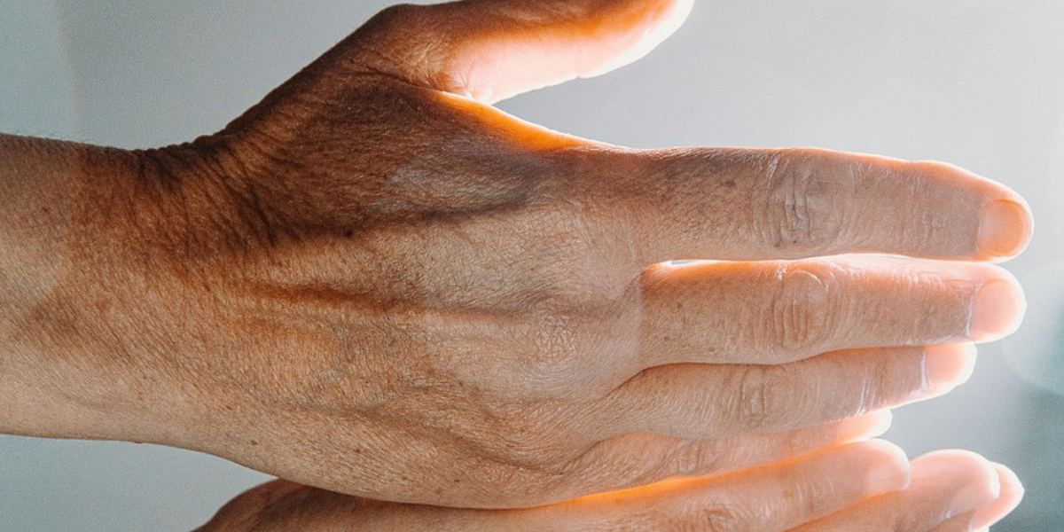 Mancha na pele da mão